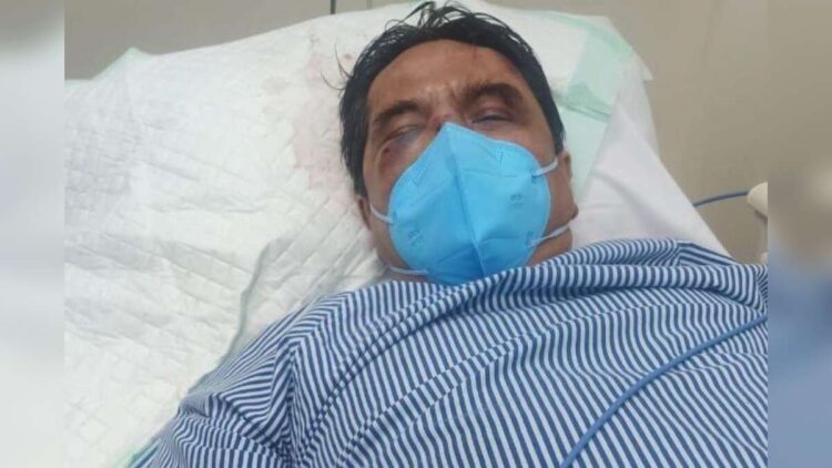 Begini Kondisi Ade Armando Usai Dikeroyok Massa di Aksi 11 April