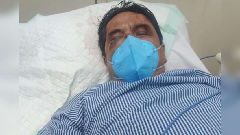 Begini Kondisi Ade Armando Usai Dikeroyok Massa di Aksi 11 April