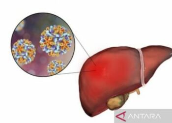 Tiongkok Punya Alat Skrining Hepatitis Misterius, Hasil Keluar 1 Jam