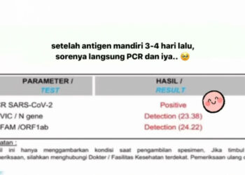 Pertahanan Ify Alyssa Jebol Juga, Positif Covid-19 dengan 3 Gejala Ini