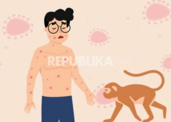 Temuan Kasus Pertama Monkeypox, Pakar Sebut 6 Upaya Yang Harus Dilakukan
