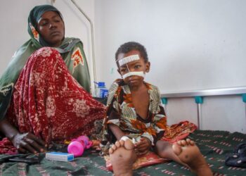 Unicef: Lebih Dari 700 Anak Somalia Meninggal Di Pusat Nutrisi