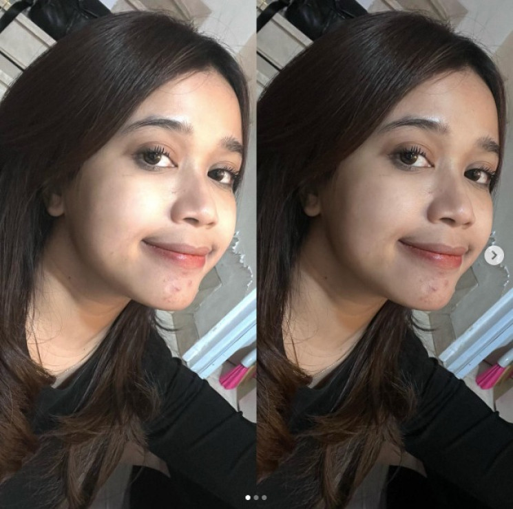 Awalnya Di-bully, Brisia Jodie Buktikan Cantik Tak Harus Berkulit Putih