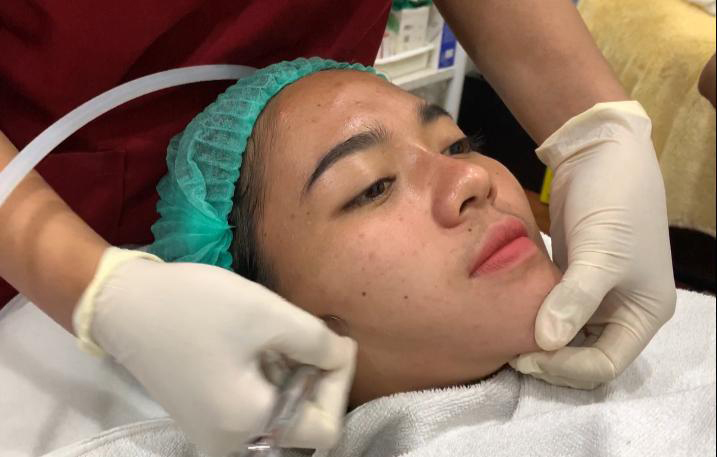 Cara Praktis Mendeteksi Umur Kulit Wajah dengan Teknologi Kecantikan Ini