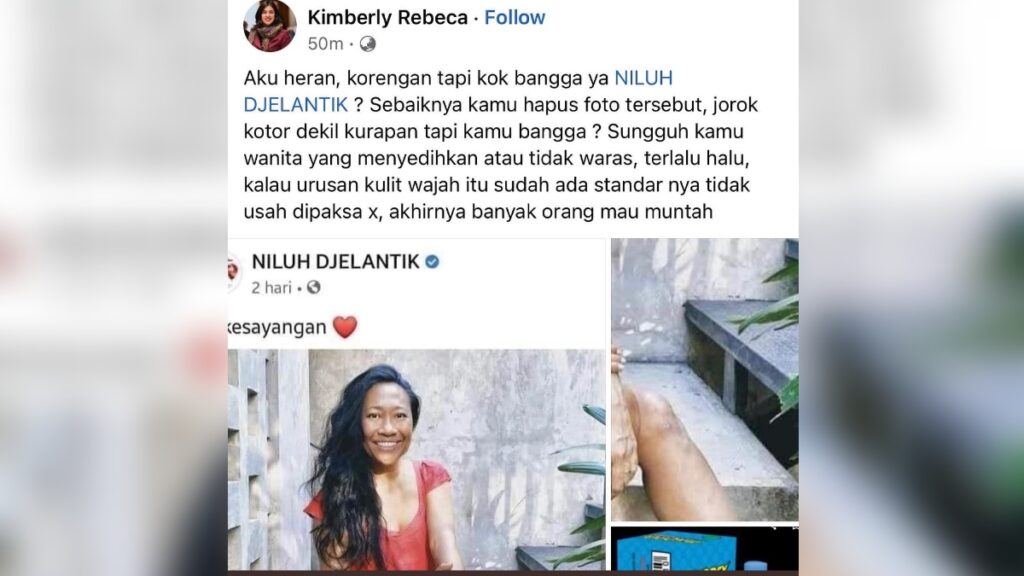 Ingin Lapor Polisi karena Dihina Korengan, Niluh Djelantik Malah Dibully: Lapor ke Dokter Kulit, Bukan Polisi!