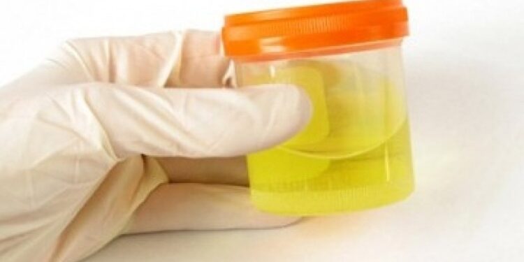 Ⓒ Hak cipta foto di atas dikembalikan sesungguhnya kepada sang pemilik foto Ⓒ Hak cipta foto di atas dikembalikan sesungguhnya kepada pemilik foto