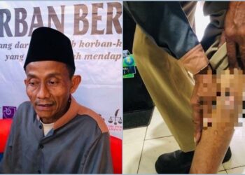 Kisah Mbah Oman: Korban Salah Tangkap Polisi, Terpaksa Ngaku Usai Kaki Ditembak