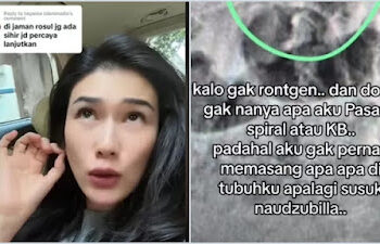 Viral Video Stevi Agnecya Ngaku Disantet Sebelum Meninggal