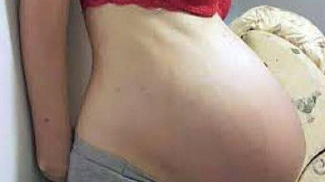 Geger, Dua Orang ODGJ di Panti Sosial Bina Grahita Hamil, Satu Sudah Melahirkan Seorang Anak