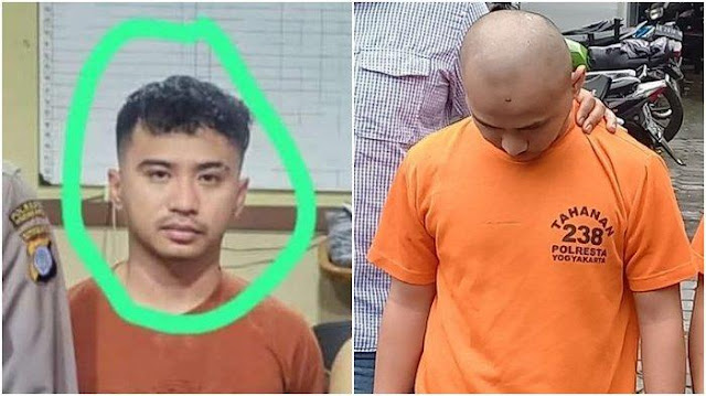 Sosok Belly Villsen, Mahasiswa S2 Hukum Otaki Penyiraman Air Keras ke Mantan, Nasibnya Terancam DO