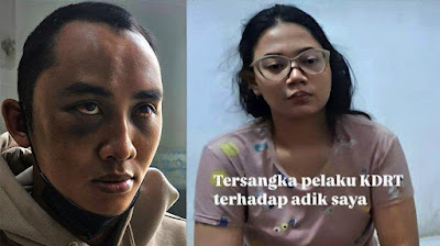 Viral, ASN Diduga Jadi Korban KDRT Istrinya hingga Babak Belur