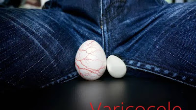 Ⓒ Hak cipta foto di atas dikembalikan sesungguhnya kepada sang pemilik foto Ⓒ Hak cipta foto di atas dikembalikan sesungguhnya kepada pemilik foto