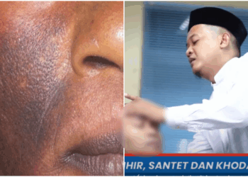 Jin Pendamping Disebut-sebut Bikin Wajah Manusia jadi Menghitam, Ini Penjelasan Pakar Ruqyah