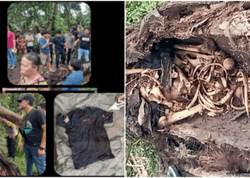 Viral Penemuan Kerangka Manusia di Dalam Pohon Aren Gegerkan Warga Serdang, Ini Penampakannya