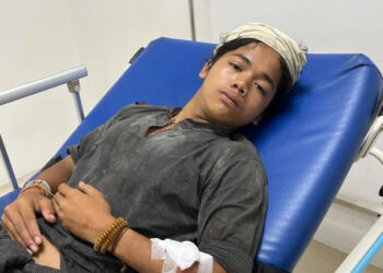 Seorang warga Baduy Dalam bernama Repan menjadi korban pembegalan hingga mengalami luka bacok di tangan kiri saat berjualan madu di wilayah Cempaka Putih, Jakarta, pada Minggu (26/10). FOTO/Net. Ⓒ Hak cipta foto di atas dikembalikan sesungguhnya kepada pemilik foto