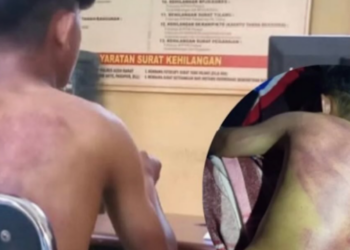 Dua Oknum TNI Dilaporkan Aniaya Pemuda Aceh Barat