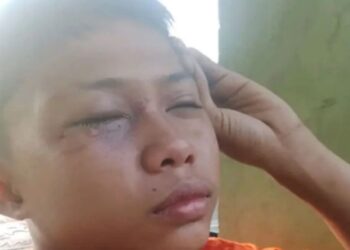Oknum Polisi di Pekanbaru Disebut Pukuli Bocah, Propam Telusuri