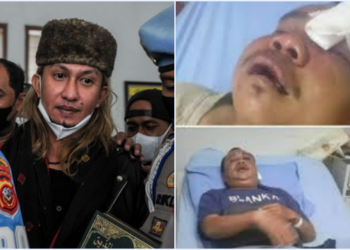 Polisi Tetapkan Bahar Bin Smith Tersangka Penganiayaan Anggota Banser, Korban Babak Belur