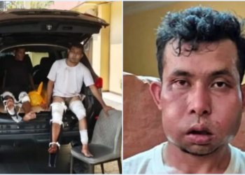 Dua Pelaku Pembunuhan Wanita Lansia di Pekanbaru Ditembak, Muka Bonyok!
