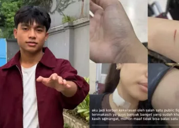 Ⓒ Hak cipta foto di atas dikembalikan sesungguhnya kepada pemilik foto Ⓒ Hak cipta foto di atas dikembalikan sesungguhnya kepada pemilik foto