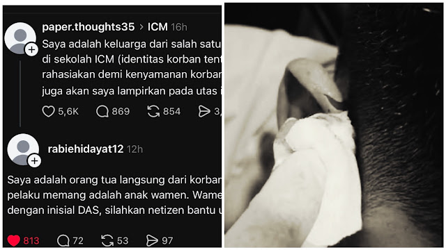 Heboh Kasus Perundungan Berat di Sekolah ICM, Pelaku Disebut Anak Wamen Inisial DAS