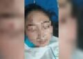 Dokter Spesialis di Cirebon Diduga Aniaya Perawat karena Cemburu Korban Punya Pacar Baru