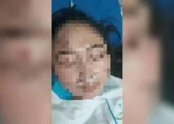 Dokter Spesialis di Cirebon Diduga Aniaya Perawat karena Cemburu Korban Punya Pacar Baru