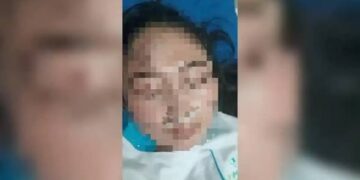 Dokter Spesialis di Cirebon Diduga Aniaya Perawat karena Cemburu Korban Punya Pacar Baru
