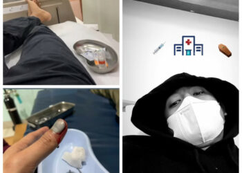 Seperti Fiki Alman, Arya Saloka Juga Masuk Rumah Sakit, Ada Apa?