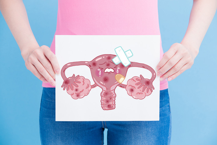Arti Warna Darah Menstruasi dan Kapan Harus Segera Menghubungi Dokter