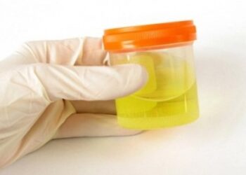 Tes urine (ilustrasi). Farma (Persero) meluncurkan program deteksi dini kanker serviks melalui pemeriksaan urine.