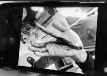 Foto hoaks yang beriringan dengan Informasi yang beredar di medsos, khususnya grup WhatsApp dengan narasi korban jambret di Limpok Aceh dan foto telapak tangan hampir putus dipastikan adalah kabar hoaks. FOTO/Net. Ⓒ Hak cipta foto di atas dikembalikan sesungguhnya kepada pemilik foto